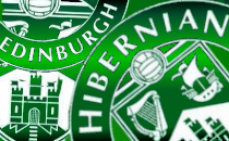 Former Hibs star headbutted ex partner in furious row over cash while children were in house